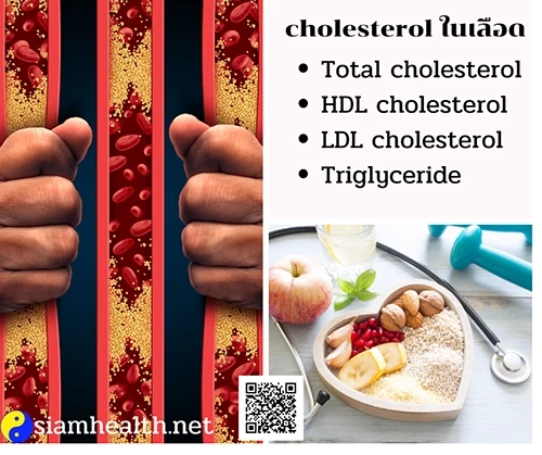ไขมันในเลือด cholesterol